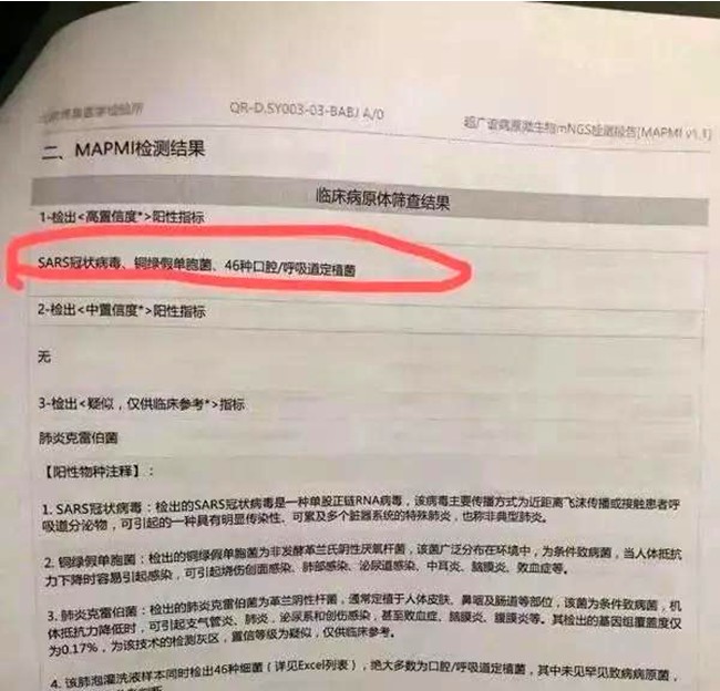 Li Wenliang forwarded the virus detection report provided by Aifen on December 30, 2019